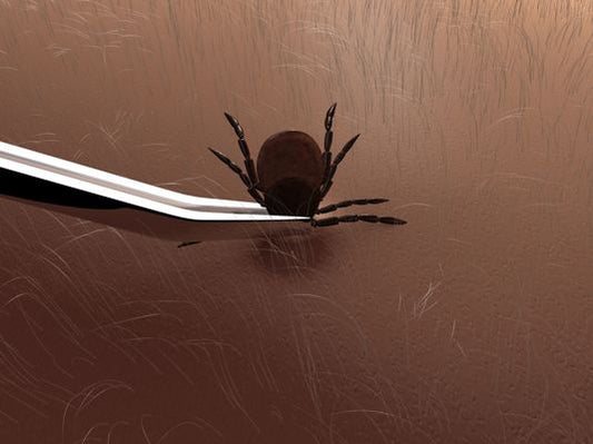Why Tweezers Are Not the Safest Way to Remove Ticks